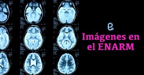 Imágenes en el ENARM y su interpretación Reto ENARM
